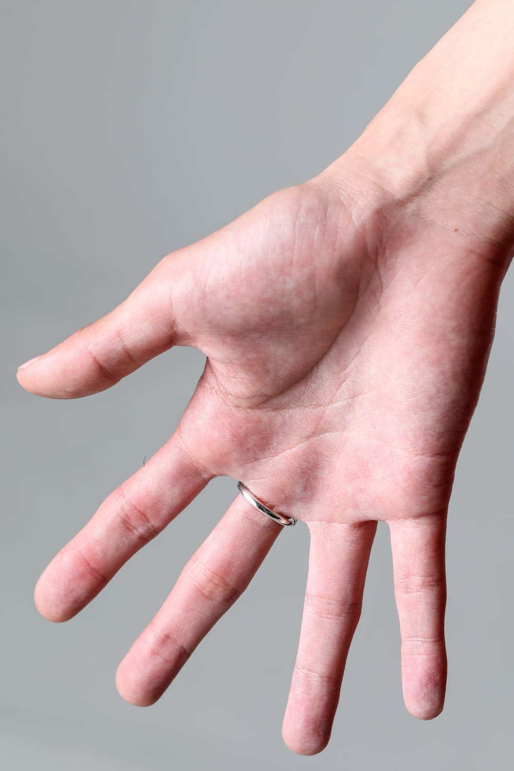 GR84 - Aretousa Ring